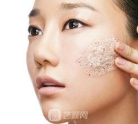 激光去粉刺果好吗？激光去粉刺大概多少钱？