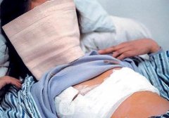 440cc假体丰胸会有多大呢？400cc丰胸图，太诱人！