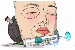 韩式果怎么样？韩式医院有哪些？