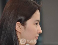 驼峰鼻矫正多少钱呢？有危险吗？术后会留疤吗？