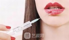 玻尿酸丰唇好不好？能保持多长时间？多久消肿呢？