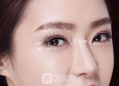 开外眼角照图片，开外眼角一定要做下至吗？