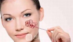 激光去红血丝怎么样掉痂快？术后如何护理以及保养呢？术后会反弹吗？