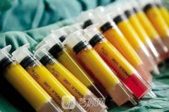 纳米脂肪是什么？成活率是多少？和普通脂肪填充有什么区别？