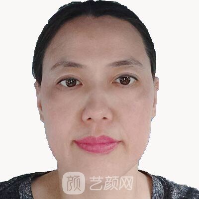 岳惠芬