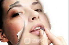彩光祛痘需要多少钱？彩光祛痘果怎么样呢？注意事项有哪些？