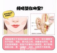 去颊脂垫恢复时间是多久？真的可以瘦脸吗？有哪些后遗症呢？