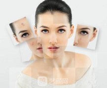 医院光子嫩肤价格是多少？多久做一次？可以保持多久呢？