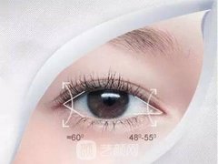 开眼角手术果图，科普开眼角手术相关知识~