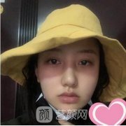 北医三院整形外科毕洪森面部吸脂果怎么样?附手术费用价格表