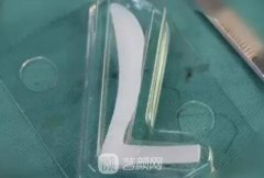 隆鼻假体材料有哪些？恢复时间需要多久？如何护理？