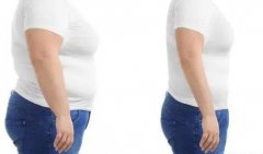 做个全身吸脂多少钱？全身吸脂减肥优势有哪些呢？