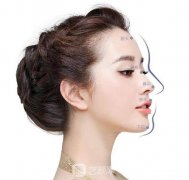 人工骨隆鼻材料是什么？没问题吗？可以维持多久呢？