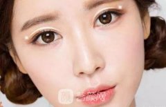 韩国开双眼皮多少钱？韩国开双眼皮有哪些方式呢？