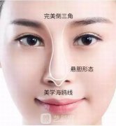 鼻翼缩小手术价钱是多少？多久可以消肿？