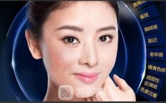 激光祛斑真的有吗？原理是怎样的呢？多久才能恢复？