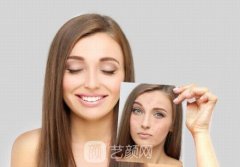 激光祛痘的价格是多少？原理是什么？多久才能恢复呢？