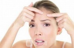 调节痤疮价格贵不贵？调节痤疮的方式是什么？