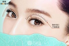 吸雕双眼皮手术过程是怎样的呢？如何进行护理呢？