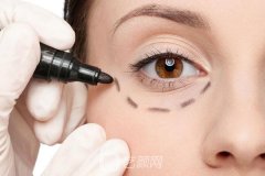 超声法去眼袋要多少钱？手术流程是怎样的呢？