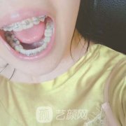 威海口腔医院补牙多少钱?2021价目表整理发布|案例图示