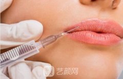 注射胶原蛋白的副作用是什么？功是什么？