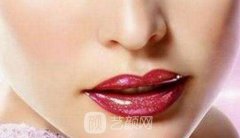 玻尿酸丰唇需要多少钱？能维持多久呢？优势有哪些？