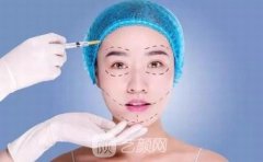 面部吸脂皮肤松弛会出现吗？术后多久可以消肿？