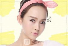 激光做双眼皮是长期的吗？多久能恢复？价格贵吗？
