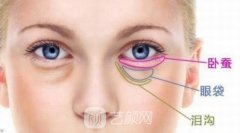 超声去眼袋多少钱？优势有哪些？术后注意事项有哪些？