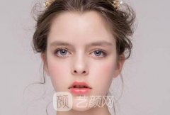 激光红血丝多少钱？优势有哪些呢？多久恢复？