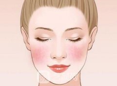 激光去红血丝好吗？优势有哪些？术后如何进行护理呢？