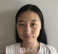 北京协和医院整形科磨骨怎么样？多少钱？