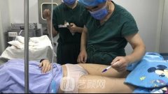 上海美立方医疗美容医院塑身怎么样？大腿吸脂塑身案例