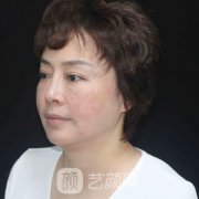 深圳美莱果怎么样？抗衰案例分享