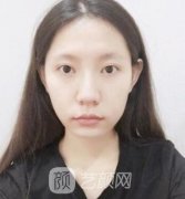 上海九院如何挂号预约？整形价目表2021，附案例