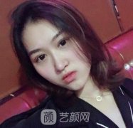 上海九院整形科抗衰老整形手术恢复图片分享