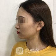 上海九院私密整形案例果图大分享|价格表2021