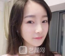 上海九院整形科韦敏医生磨骨技术怎么样？案例分享