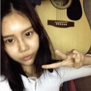 上海九院魏皎案例，鼻部手术术前术后分享~