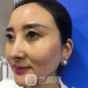 西京医院整形科拉皮除皱怎么样？价格表透明！