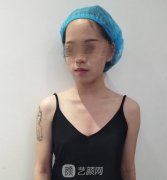 北京协和医院隆胸2021案例，凹凸身材轻松塑造