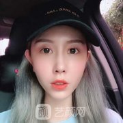 昆明美立方医院私密案例术后果体验分享