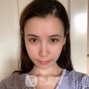 成都二医院整形科热玛吉价格表公开！抗衰除皱案例同步！