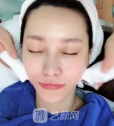 南京华美美容医院热玛吉怎么样?可看真人案例果图
