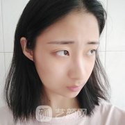 南京康美美容医院打注射瘦脸真人案例图！