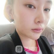 大连大学附属新华医院整形外科厚唇改簿谁做的好？专家及案例一一介绍！