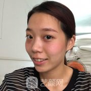 长春中妍奥拉克五代热玛吉正规吗？抗衰除皱果