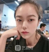 上海皮肤病医院可以做热玛吉吗?抗衰案例果及价格清单全透明！