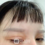 上海长征医院整形科纹眉怎么样？价格表2021和案例果图一览